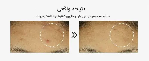 سرم 6 پپتاید کوزارکس COSRX - Image 5